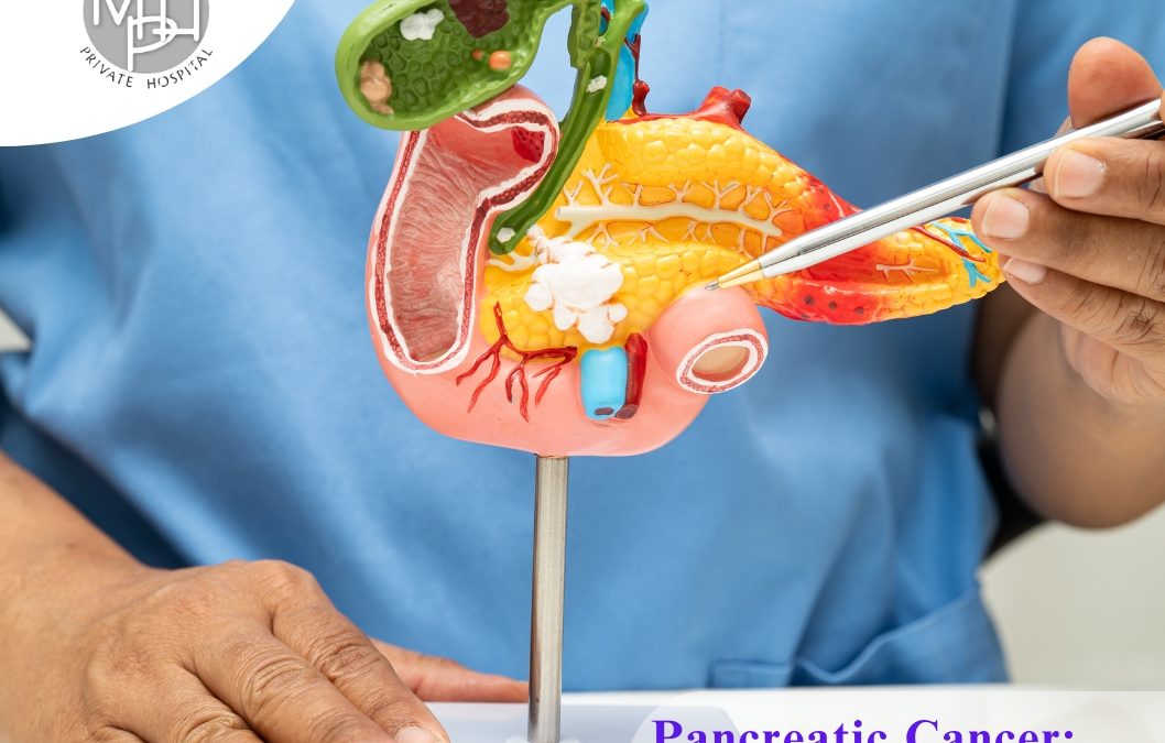 Pancreatic Cancer: Early Warning Signs